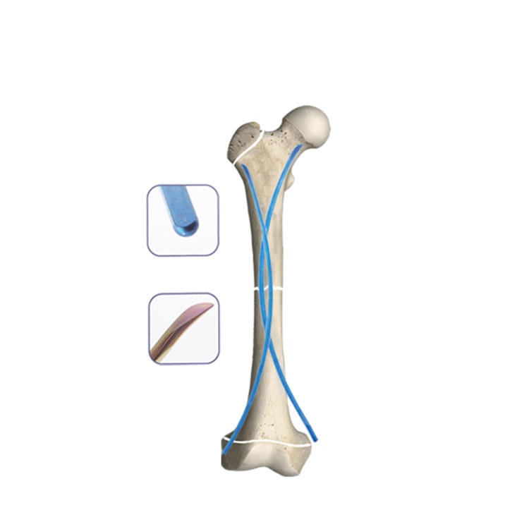 Elastic Intramedullary Pin