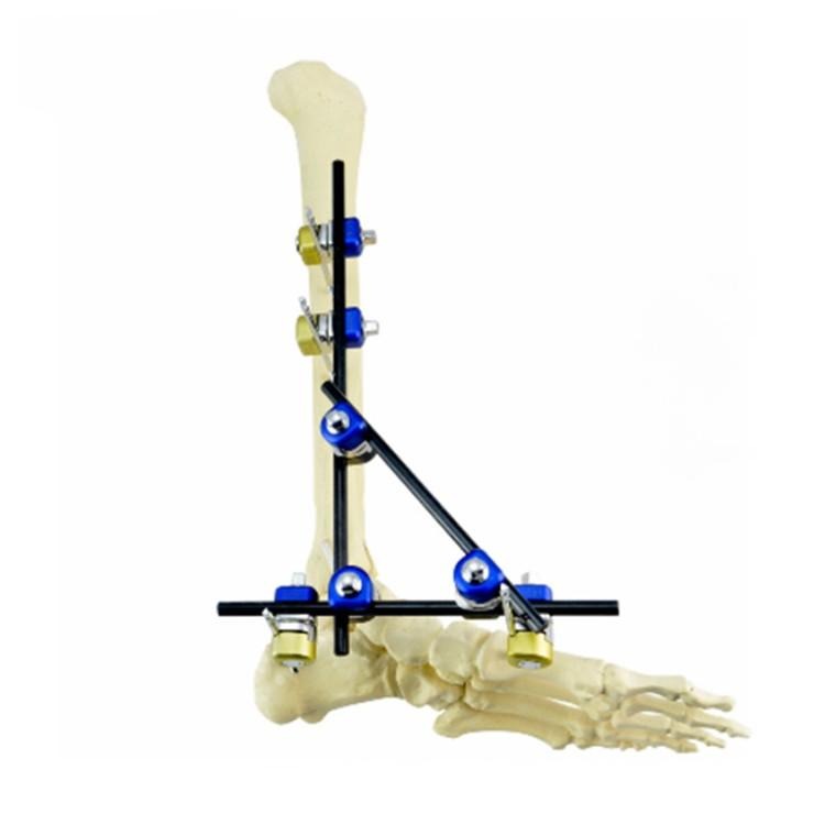 Ankle Combined Fixator