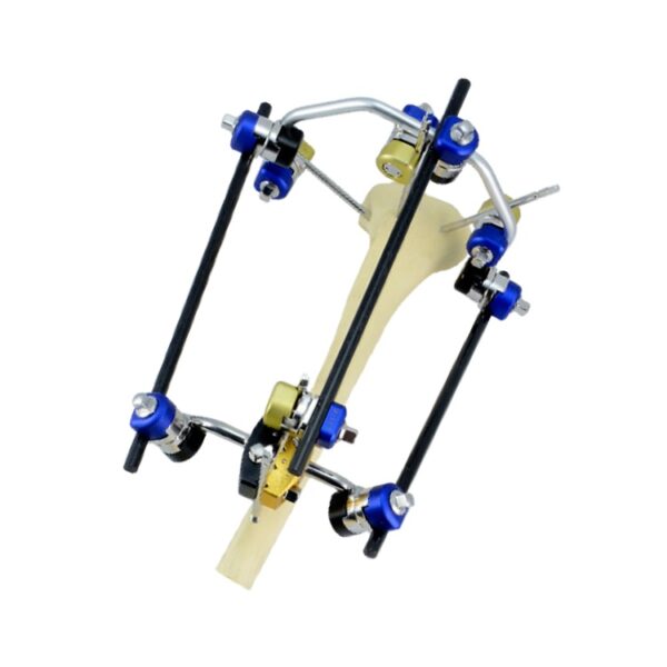 Proximal Tibial Combined External Fixator
