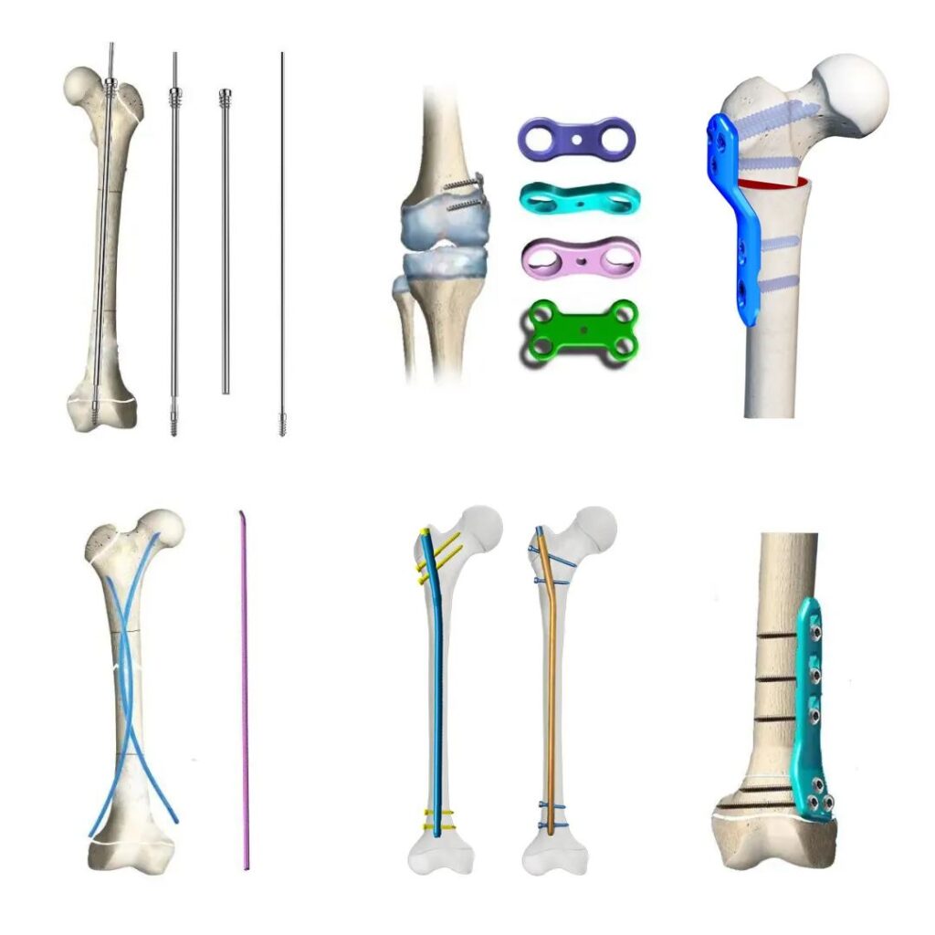 pediatric implants