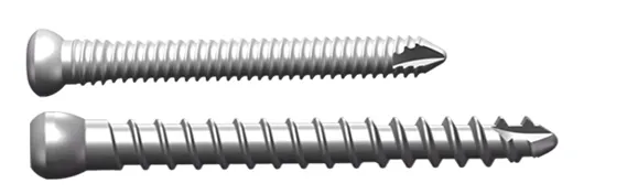 Intramedullary Nail for Ankle Arthrodesis 2