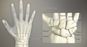 Dom 16 Anatomy and Frequency of Carpal Fractures
