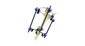 Hoffmann Fixator Everything You Need to Know in One Read 1