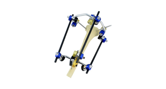 Hoffmann Fixator Everything You Need to Know in One Read 1